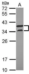 Anti-V-ATPase D antibody used in Western Blot (WB). GTX119155