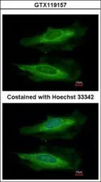 Anti-HECA antibody [C1C3] used in Immunocytochemistry/ Immunofluorescence (ICC/IF). GTX119157