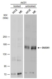 Anti-DUOX1 antibody [N1N3] used in Western Blot (WB). GTX119160