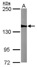 Anti-WDR19 antibody [N1N2], N-term used in Western Blot (WB). GTX119202