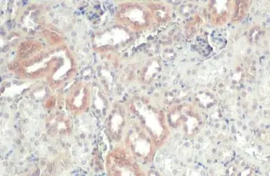 Anti-ZNF598 antibody [N1N3] used in IHC (Paraffin sections) (IHC-P). GTX119245