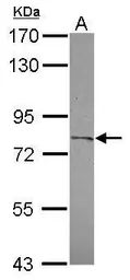 Anti-CPXM2 antibody [C2C3], C-term used in Western Blot (WB). GTX119255