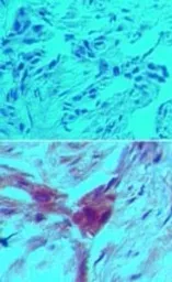 Anti-D4 GDI (cleaved specific) antibody [97A1015] used in IHC (Paraffin sections) (IHC-P). GTX11927