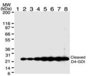 Anti-D4 GDI (cleaved specific) antibody [97A1015] used in Western Blot (WB). GTX11927