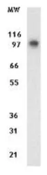 Anti-DAP5 antibody [39C534.1] used in Western Blot (WB). GTX11929