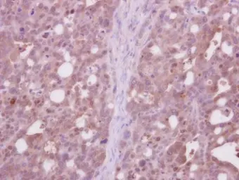 Anti-CDC37L1 antibody [N3C3] used in IHC (Paraffin sections) (IHC-P). GTX119311