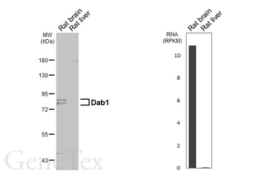 Anti-Dab1 antibody [N1N3] used in Western Blot (WB). GTX119336