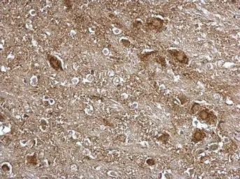 Anti-ITM2B antibody used in IHC (Paraffin sections) (IHC-P). GTX119361