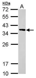 Anti-Calponin 2 antibody used in Western Blot (WB). GTX119368