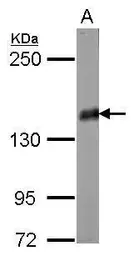 Anti-Liprin alpha 2 antibody used in Western Blot (WB). GTX119392