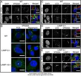 Anti-VPS33A antibody [C1C3] used in Immunocytochemistry/ Immunofluorescence (ICC/IF). GTX119416
