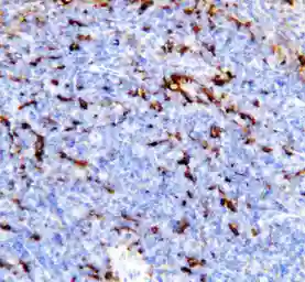 Anti-TREM1 antibody used in IHC (Paraffin sections) (IHC-P). GTX11944