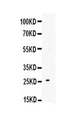 Anti-TREM1 antibody used in Western Blot (WB). GTX11944