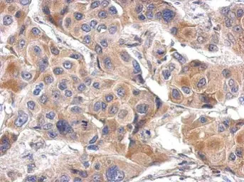 Anti-LILRA4 antibody [N2C2], Internal used in IHC (Paraffin sections) (IHC-P). GTX119457