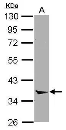 Anti-Annexin VIII antibody [N1C2] used in Western Blot (WB). GTX119470