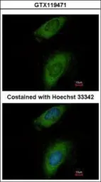 Anti-Annexin VIII antibody [N2C3] used in Immunocytochemistry/ Immunofluorescence (ICC/IF). GTX119471