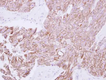 Anti-TMPRSS11B antibody [N1C1] used in IHC (Paraffin sections) (IHC-P). GTX119482