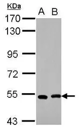 Anti-SMYD1 antibody used in Western Blot (WB). GTX119484