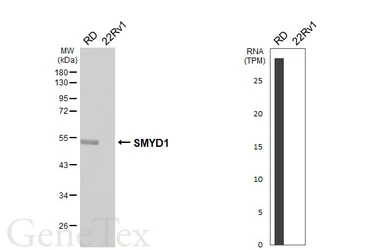 Anti-SMYD1 antibody used in Western Blot (WB). GTX119484
