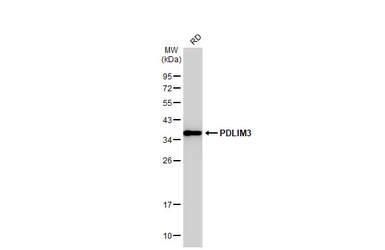 Anti-ALP / PDLIM3 antibody used in Western Blot (WB). GTX119505