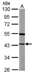 Anti-SPSB3 antibody [N1C2] used in Western Blot (WB). GTX119568