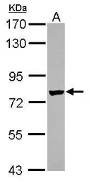 Anti-Netrin G1 ligand antibody [C1C3] used in Western Blot (WB). GTX119612