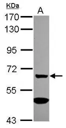 Anti-MGAT4A antibody [C1C3] used in Western Blot (WB). GTX119640