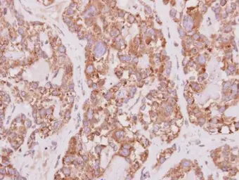 Anti-PCYOX1 antibody used in IHC (Paraffin sections) (IHC-P). GTX119652
