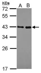 Anti-NRBF2 antibody [N2C3] used in Western Blot (WB). GTX119687