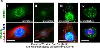 Anti-PIP5K2 gamma antibody [N2N3] used in Immunocytochemistry/ Immunofluorescence (ICC/IF). GTX119713