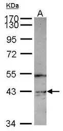 Anti-PIP5K2 gamma antibody [N2N3] used in Western Blot (WB). GTX119713