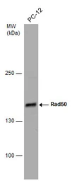 Anti-Rad50 antibody [N1N2], N-term used in Western Blot (WB). GTX119731