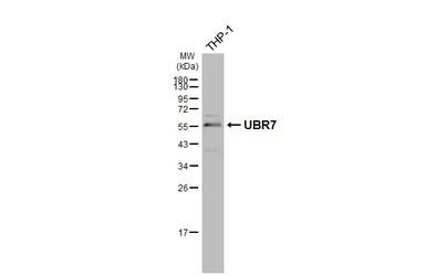 Anti-UBR7 antibody used in Western Blot (WB). GTX119742