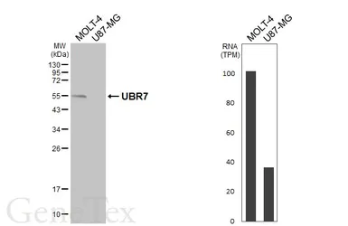 Anti-UBR7 antibody used in Western Blot (WB). GTX119742