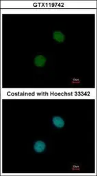 Anti-UBR7 antibody used in Immunocytochemistry/ Immunofluorescence (ICC/IF). GTX119742
