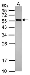 Anti-UBR7 antibody used in Western Blot (WB). GTX119742