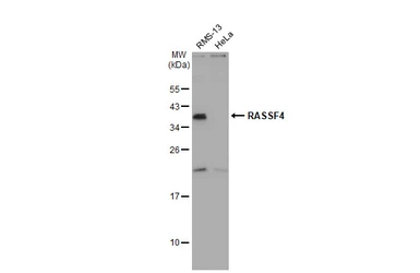 Anti-RASSF4 antibody [N1C1] used in Western Blot (WB). GTX119774