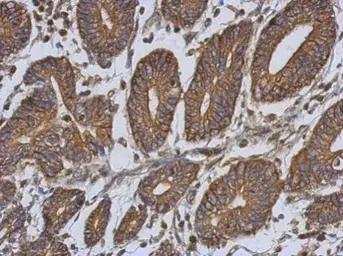 Anti-EPLIN antibody [N1N2], N-term used in IHC (Paraffin sections) (IHC-P). GTX119780
