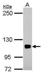 Anti-EPLIN antibody [N1N2], N-term used in Western Blot (WB). GTX119780