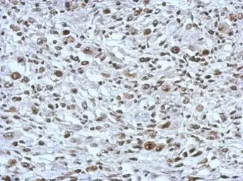 Anti-THAP11 antibody [N1C3] used in IHC (Paraffin sections) (IHC-P). GTX119804
