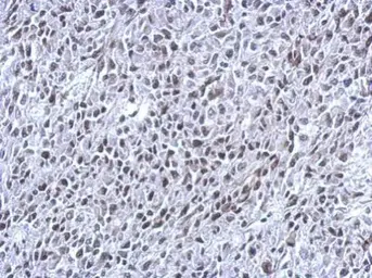 Anti-THAP11 antibody [N1C3] used in IHC (Paraffin sections) (IHC-P). GTX119804