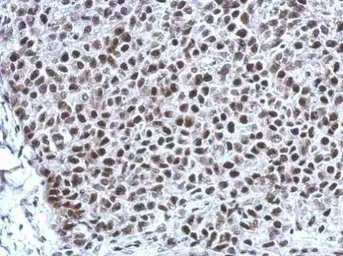 Anti-THAP11 antibody [N1C3] used in IHC (Paraffin sections) (IHC-P). GTX119804