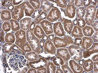 Anti-CHCHD3 antibody [N1C3] used in IHC (Paraffin sections) (IHC-P). GTX119821