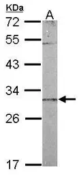 Anti-CHCHD3 antibody [N1C3] used in Western Blot (WB). GTX119821