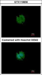 Anti-CATSPERB antibody [N1N2], N-term used in Immunocytochemistry/ Immunofluorescence (ICC/IF). GTX119836