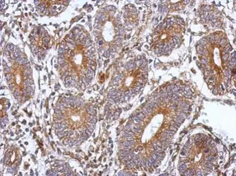 Anti-SPAG8 antibody used in IHC (Paraffin sections) (IHC-P). GTX119963