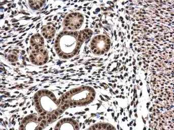 Anti-RPRD1B antibody used in IHC (Paraffin sections) (IHC-P). GTX119969