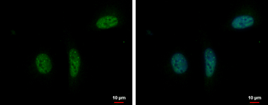 Anti-RPRD1B antibody used in Immunocytochemistry/ Immunofluorescence (ICC/IF). GTX119969