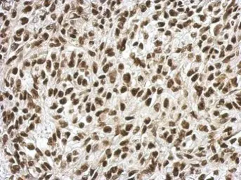 Anti-RPRD1B antibody used in IHC (Paraffin sections) (IHC-P). GTX119969