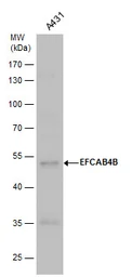 Anti-EFCAB4B antibody used in Western Blot (WB). GTX120035